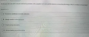 NR576 Week 4: Midterm Exam
